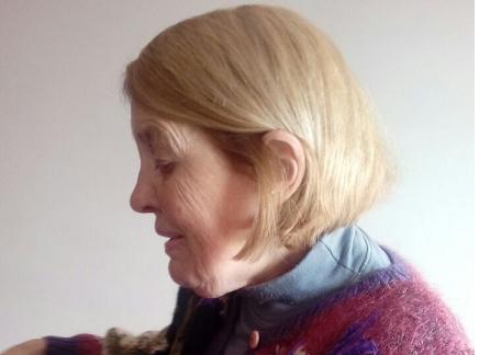 Eran las dos de la tarde, había poca gente y el chico en moto paso muy rápido. Yo venía caminando por la calle”