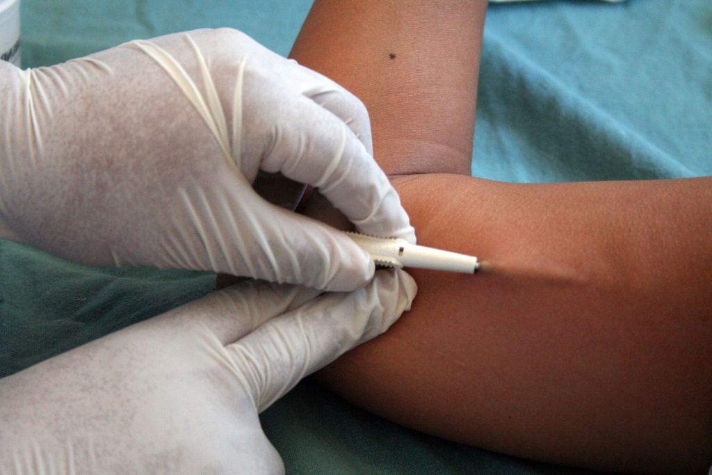 El Hospital Abel Ayerza y un nuevo método anticonceptivo subdérmico