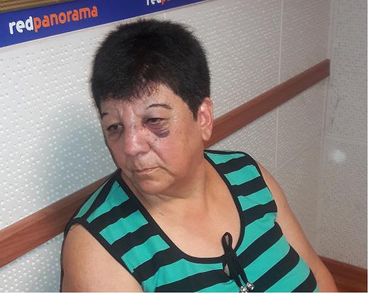 Rosa Rodriguez y una denuncia por golpes y agresión de parte de su vecino