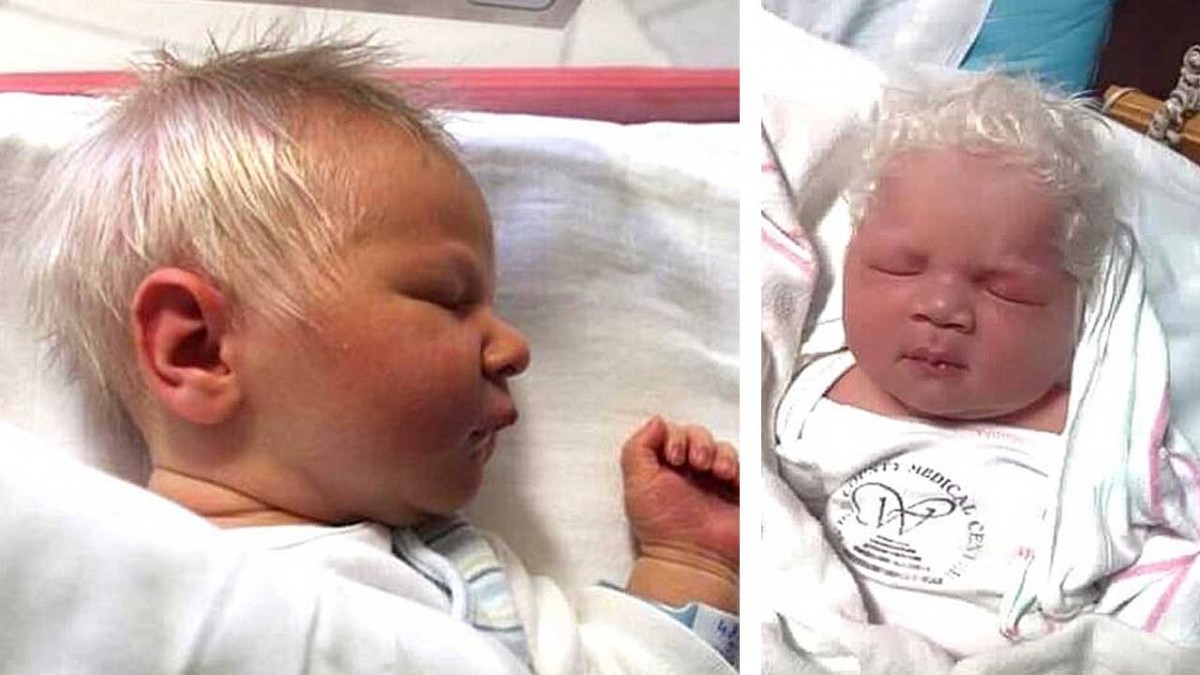 Hungría: el extraño caso del bebé que nació con el cabello blanco