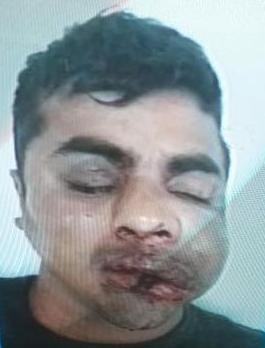 General Roca: boliche, pelea y un joven en terapia intensiva derivado al Hospital de Marcos Juàrez