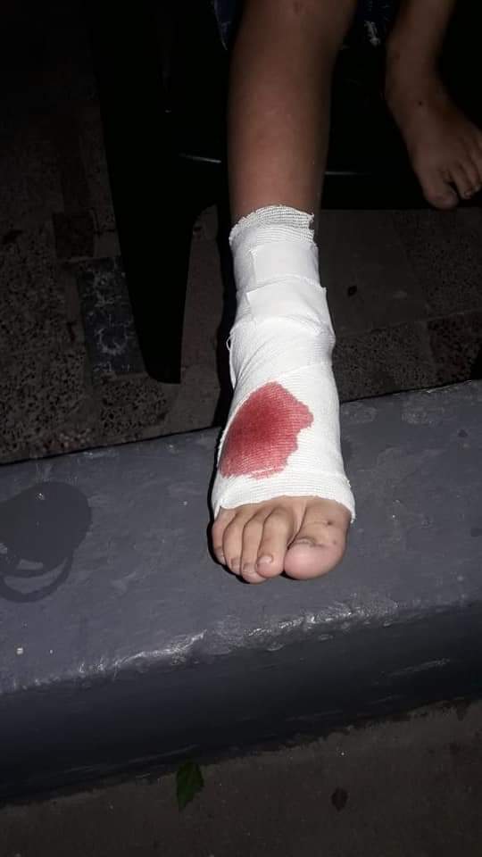 Marcos Juarez: Joven de 11 años fue atacado por un Pitbull
