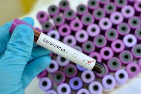 2 nuevos casos de Coronavirus en la provincia